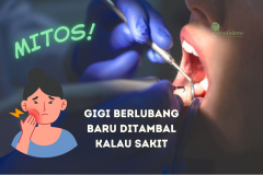 Mitos: Gigi Berlubang Baru Ditambal Kalau Sakit