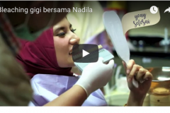 Memutihkan Gigi Secara Instan