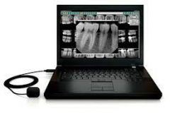PERIAPICAL DIGITAL X-RAY
