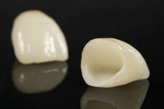 PORCELAIN CROWN